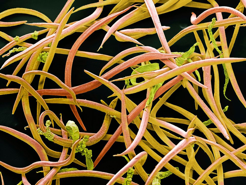 Så här ser de ut i mikroskop, nematoderna Phasmarhabditis hermaphrodita som angriper mördarsniglar.